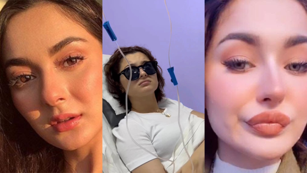 Dermatologists Claim Hania Amir Has Undergone Facial Surgeries